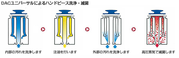 DACユニバーサルによるハンドピース洗浄・殺菌