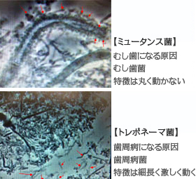 ミュータンス菌とトレポネーマ菌